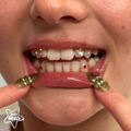 Zahnschmuck